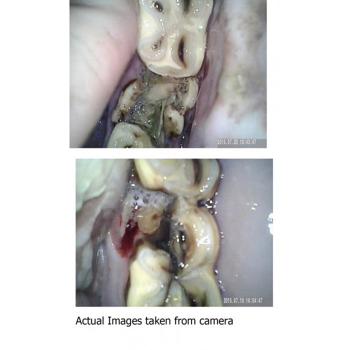 Equine Dental Endoscope Camera for Veterinary Procedures