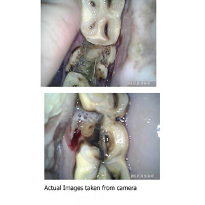 Caméra endoscopique dentaire équine pour procédures vétérinaires